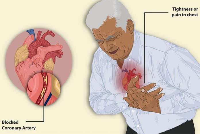 091023_bangladesh_pratidin_Heart_Attack