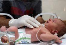 গাজায় মায়ের মৃত্যুর পরও অলৌকিকভাবে বেঁচে গেল গর্ভের শিশু